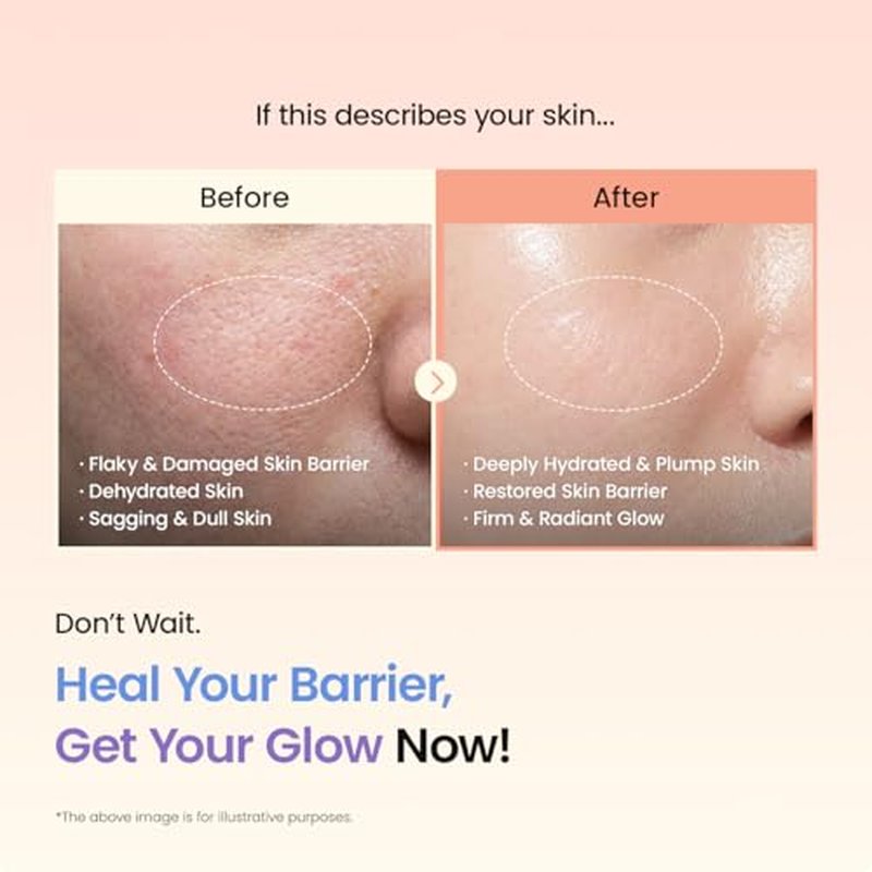 BIODANCE Barrier Rescue Duo: Caviar PDRN & Ceramide Panthenol Real Deep Overnight Gel Mask for Hydrating Plumping for Glass Skin, Korean Skin Care, Skin Care Set
