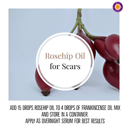 d?ve herbes Rosehip Oil (Rosa rubiginosa) | Cold Pressed | Pure | Natural | Undiluted | For Diluting Essential oils | For Skin & Massage | Non-Sticky| Lightweight| Men & Women | 50ml (1.69 oz)