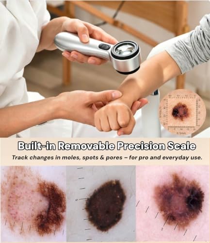 30x Portable Magnifying Dermatoscope with LED Light Modes for Skin & Scalp