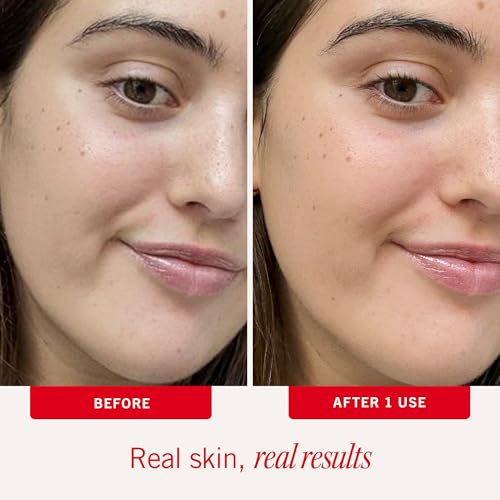 First Aid Beauty Ultra Repair Face Moisturizer - White, Hydrating, Lightweight, Sensitive Skin