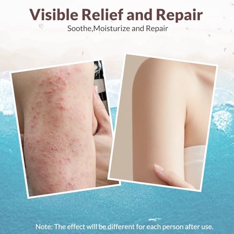 Crogooe Natural Soothing Eczema Cream for Dry & Itchy & Sensitive Skin - Fragrance-Free Moisturizer with Sea Moss, Aloe Vera & Oats for Intense Hydration & Comfort £¬Safe for All Ages (4 oz)