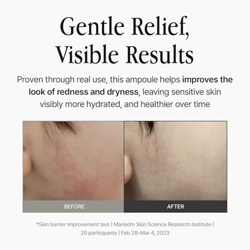 Ampoule 1.35 fl oz ? Lightweight Hydrating Serum with Panthenol, Witch Hazel Water & Amino Acid Complex, pH 5.5 Moisture Balance for Sensitive Skin
