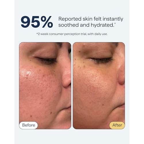 Remedy for Light Moisture | Barrier Repairing Hydrating Lightweight Gel Moisturizer Water Cream for Normal to Oily Skin | By Dermatologist Dr. Shah, 1.7 fl. Oz
