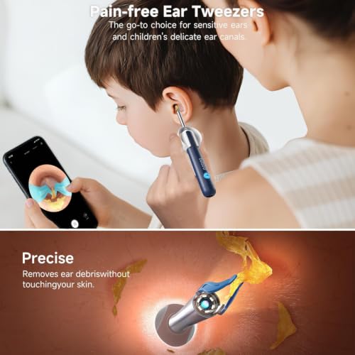 BEBIRD R1 Ultra Ear Wax Removal Kit with 1296P HD Ear Camera – Blue