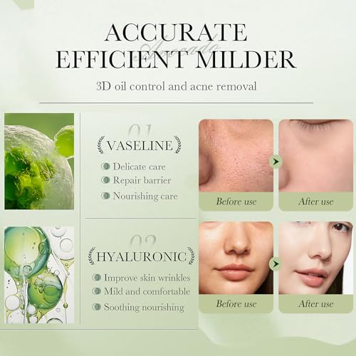 Avocado Skin Care Set for Women, 6-In-1 Skincare Gift Set With Facial Cleanser, Face Serum, Face Cream, Eye Cream, Toner, moisturizing lotion. Skin Care Sets & Kits, Hydrating Facial Kit