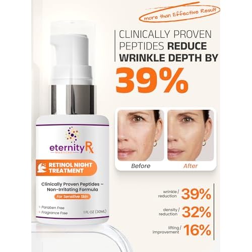 Retinol Night Cream with Vitamin A, Matrixyl 3000, Vitamin C & Daisy Extract ? Anti-Aging Night Treatment for Fine Lines, Skin Tone & Wrinkles ? Non-Irritating ? by Eternity Medicine 1oz