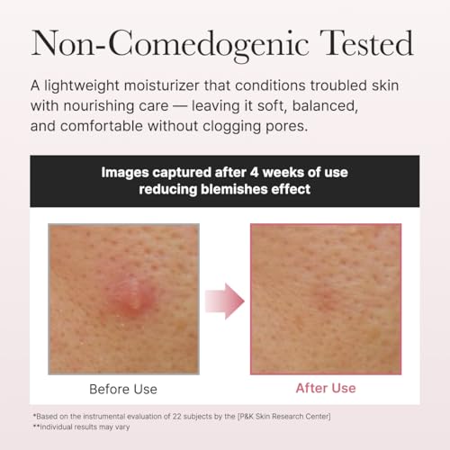 ARENCIA Red Smoothie Lotion 5% Niacinamide Face Moisturizer with Peptides & Collagen – 6.76 fl oz