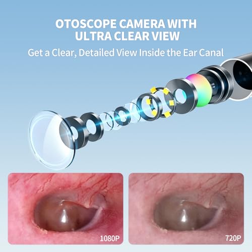 AudScope Digital Ear Otoscope with 4.5" HD Screen, 3.9mm Camera, 8 Tips & 3-Level Light