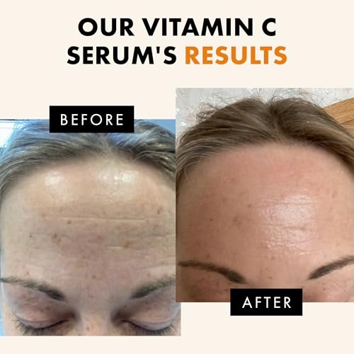 Eclat Skincare Vitamin C Serum + Hyaluronic Acid Serum Duo ? Vit C with Ferulic Acid & Vit E + 2.5% Hyaluronic Acid & B5 ? Brightening, Plumping & Smoothing Skin Care Set 1 fl oz each