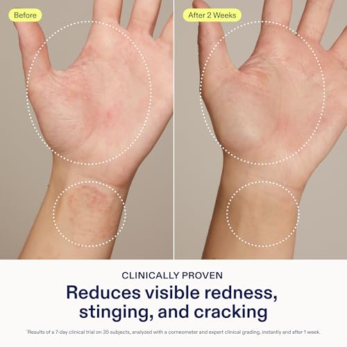Skinfix Hand Relief Cream - Fragrance Free, 3 fl oz for Dry, Sensitive Hands