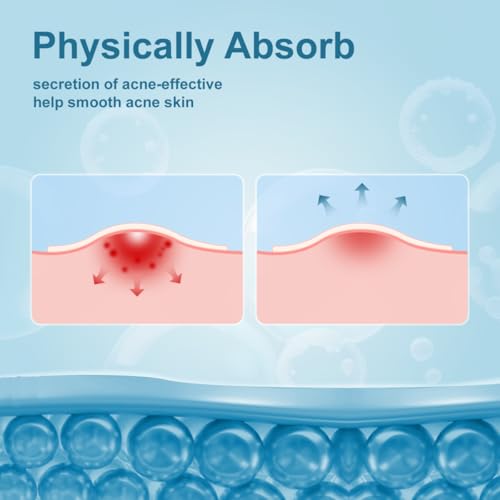 Pimple Patches for Face, Hydrocolloid Acne Patches, Absorb Zits and Blemishes, Invisible Spot Cover, Treatment for Breakouts, Acne Stickers with Salicylic Acid and Tea Tree Oil (24 Count)