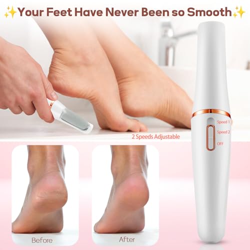 Ingrown Toenail Clippers for Seniors Thick Toenails, Straight Nail Clipper for Men,Angled Head Large Toe Nail Clippers Set for Men