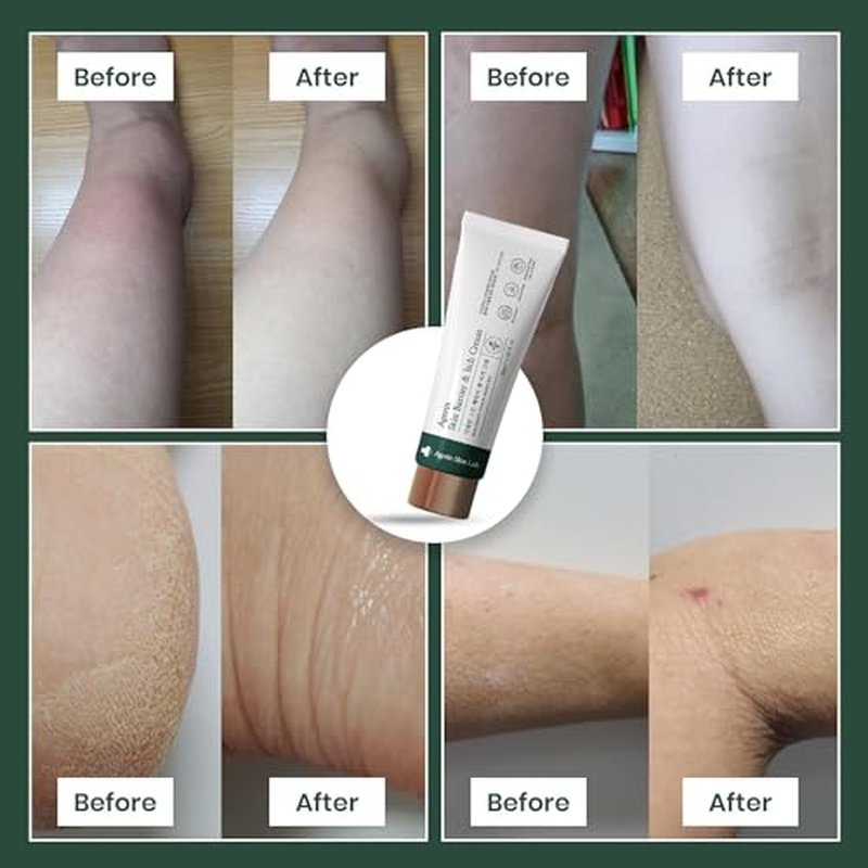 Anti-Itch Cream ? Skin Barrier and Itch Relief Cream for Sensitive and Dry Skin, Trouble Care, Calming, Hydrating, Purifying, Cruelty Free, Vegan