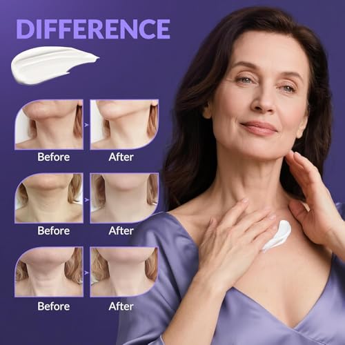 Neck Cream for Tightening and Firming, Fast-Absorbing Anti-Aging Neck & Face Cream with Collagen & Peptides, Visible Results in Days, Daily Moisturizing for Neck, Face & Chest, 1.7 Fl Oz