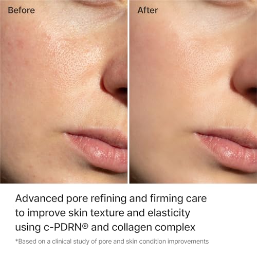 Pore Tightening Hydrogel Mask with Collagen & c-PDRN - 5 Count