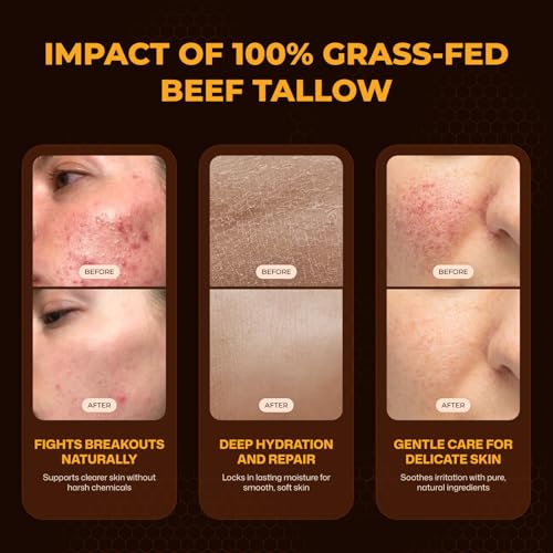 VIORY Tallow and Honey Balm for Face, Beef Tallow for Skin, Moisturizer with 100% Organic Grass-Fed Beef Tallow & Raw Wild Honey - Natural Formula for Dry & Sensitive Skin (Unscented)