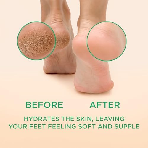 Lee Beauty Professional Callus Remover for Feet - Original, Powerful Formulation - Extra Strength Gel, Home Pedicure Foot Spa Results - Cracked & Dead Dry Skin Supplies - 8 Oz