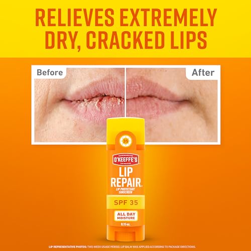 O'Keeffe's Lip Repair SPF 35 Lip Balm Stick - Sun Protection, Dry & Cracked Lips, Pack of 6