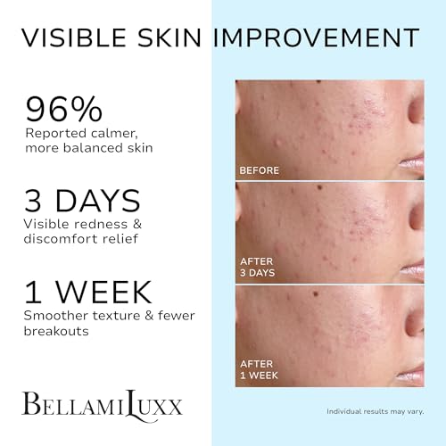 1-Pack Cystic Acne Spot Treatment with Salicylic Acid & Tea Tree Oil for Face