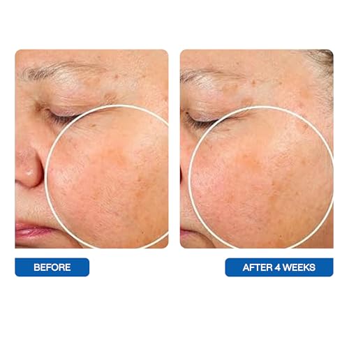 Microbiome Face Cleanser with MicroSilverBG - 5 Ounce, No Color, Pack of 1