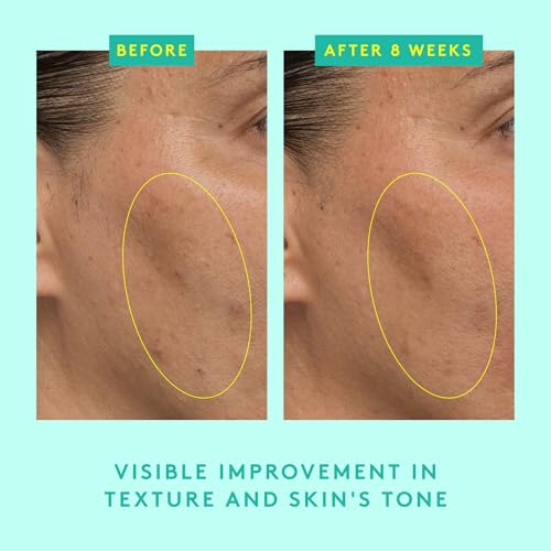 Lactic Acid Serum with Peptides - Exfoliating Face & Skin Care, 30ml