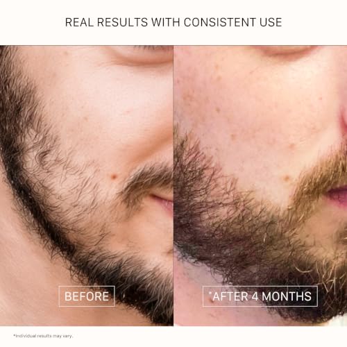 Densifying Beard Oil 30mL - Classic Scent for Fuller, Softer Beard