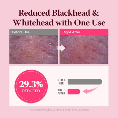 HIMALAYA PINKSALT Pore & Blackhead Deep Cleansing Oil BHA, 6.7 fl oz 2 Pack - Pore Purifying Oil Cleanser with BHA for Blackhead Removal, Makeup Remover with Refreshing Low Alkaline Formula