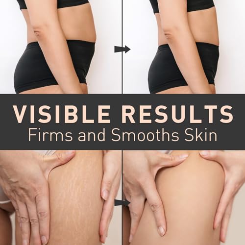 Belly Firming Cream for Cellulite & Stretch Marks - Hydrating Body Lotion for Women & Men