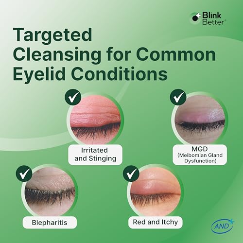 BetterLids Eyelid Relief Bundle ? Cleansing Gel with Tea Tree & Centella (1.06 oz) + Soothing Hydration Ointment with Oat Complex & Shea Butter (0.35 oz) ? Daily Care for Dry, Flaky, Sensitive Eyelids