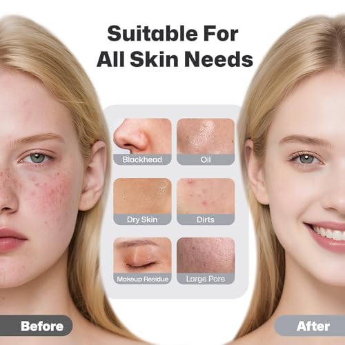PRITECH Facial Cleansing Brush, Rechargeable Silicone Face Scrubber with Constant-Temperature Heating, Vibrating Exfoliator Scrubber for Deep Pore Cleaning, Waterproof Face Brush for Women & Men-Black
