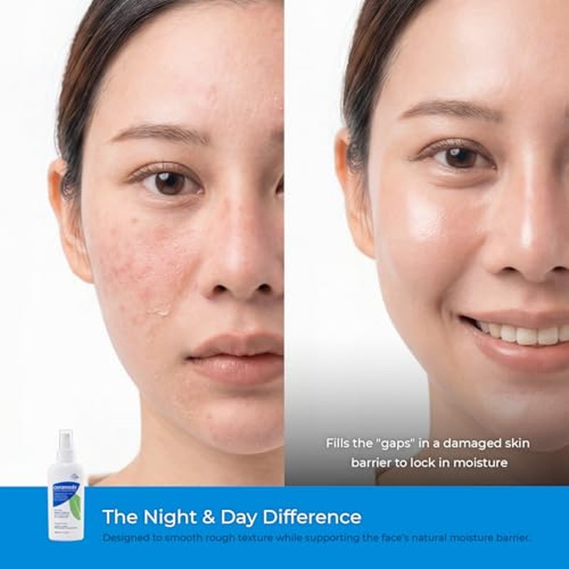 Ceramedx ? Soothing Facial Lotion | Natural Ceramide Lotion for Dry, Sensitive Skin | Cruelty Free, Vegan & Fragrance Free | 4 fl oz