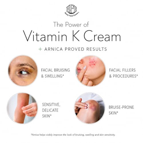 Vitamin K Cream with Arnica for Bruising Dark Circles & Spider Veins – Moisturizing Face & Body Care