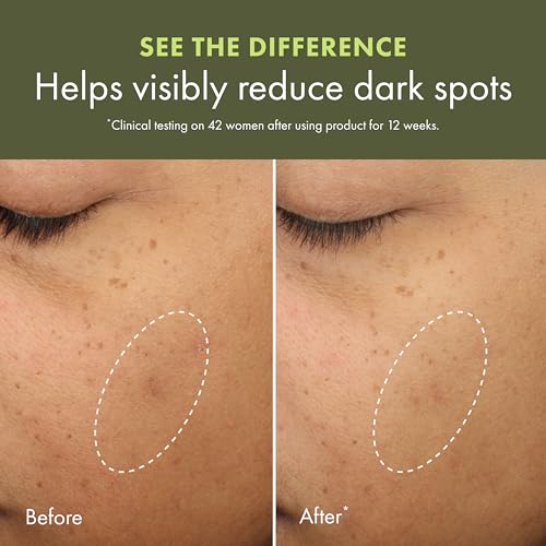 Dark Spot Corrector Cream with Vitamin C & Reishi Mushroom - Brightening & Even Skin Tone - 1.7 Fl Oz