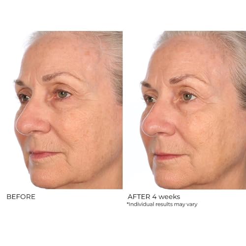 NassifMD Peptide Collagen Serum with Hyaluronic Acid & Beta Glucan for Skin Tightening