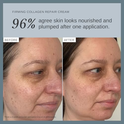 Alpha-H Firming Collagen Face Cream - Moisturizer for Dry, Sensitive Skin 50ml