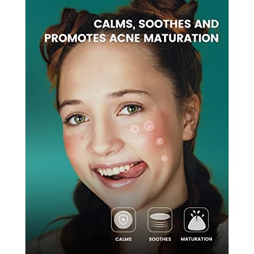 Pimple Patch 420 Counts 4 Sizes, Hydrocolliod Acne Patch for Face, Invisible Zit Patch with Tea Tree Oil & Calendula Oil, Blemish Patch, Vegan and Cruelty Free