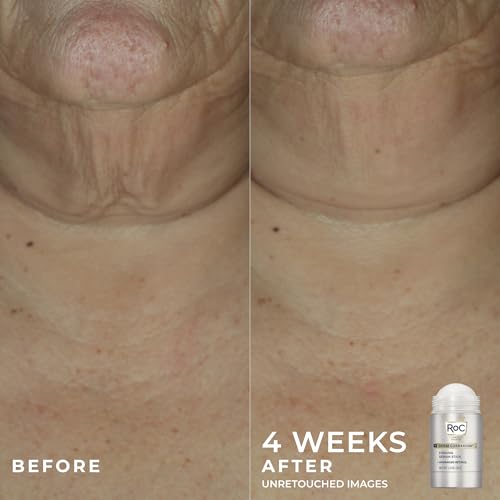 Bundle of RoC Derm Correxion Lip Volumizer - Lip Plumper Peptide Treatment with Hyaluronic Acid & Vitamin E + RoC Derm Correxion Retinol Firming Serum Stick