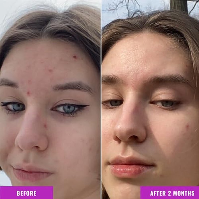 Good Molecules Niacinamide Serum ? 10% Niacinamide to Target Blemishes, Nourishment, and Skin Tone ? Ultra Hydrating & Brightening Skin Care for Face ? 75 ml / 2.53 fl oz