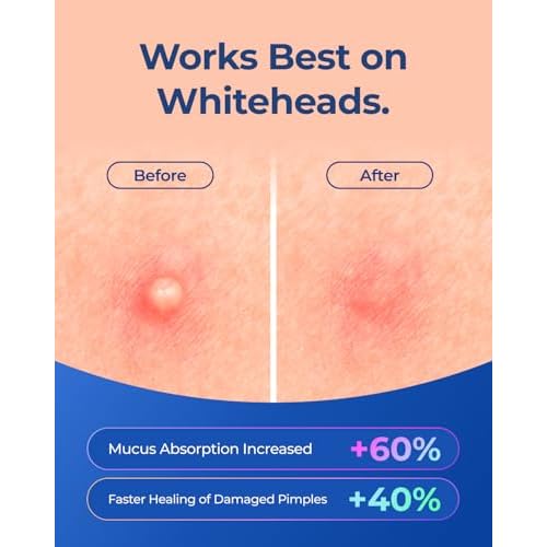 White Turmeric Powder for Skin Care | 8 oz | No staining | aka Kapoor Kachri & Hedychium Spicatum | 100% Herbal Skin Care by Yogi¡¯s Gift