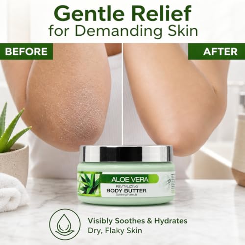 Hydrating Body Butter for Dry Skin - Mango, Shea & Argan Oil, 8 Oz