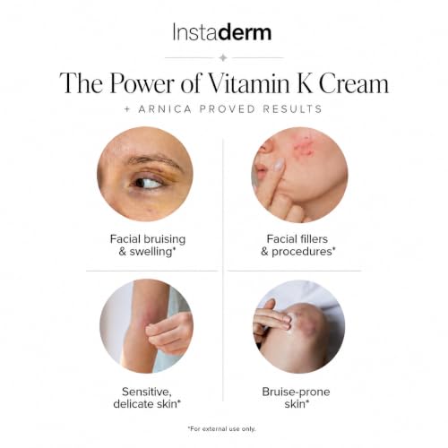 Vitamin K Cream for Bruising & Dark Circles with Arnica - Under-Eye & Skin Care