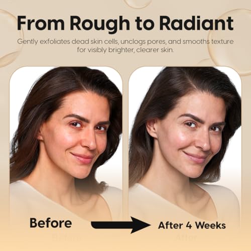2% Salicylic Acid Blemish & Dark Spot Serum+Toner-Minimizes Pores, Ingrown Hair&keratosis Pilaris?Face&Body, Oily & Combination Skin-with Niacinamide, Alpha-arbutin &Witch Hazel 6.8 FL Oz