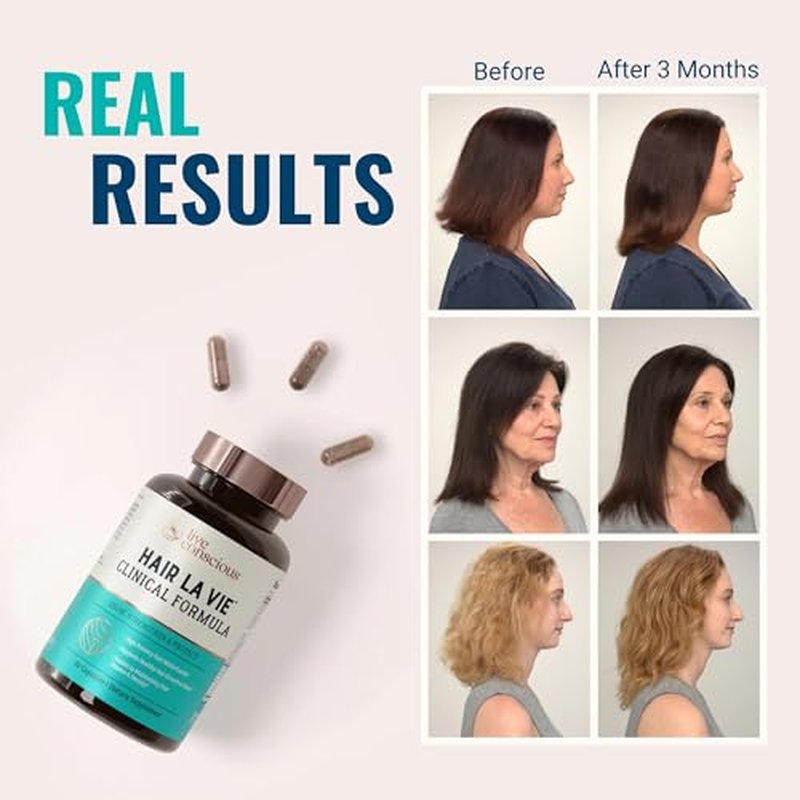 Hair La Vie Live Conscious Clinical Formula Hair Growth Vitamins for Women and Men w/Biotin, Collagen & Saw Palmetto (Pack of 1)