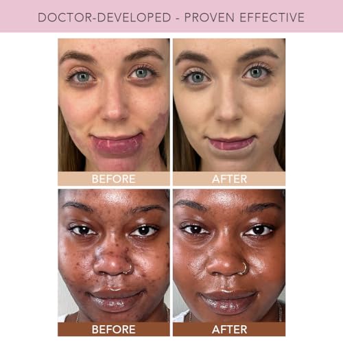 Doll 10 TCE Liquid Filter ? CC Cream Foundation - Liquid Foundation - Lightweight Tinted Moisturizer & Skin Tint - Blurs Pores & Fine Lines - Vegan - Clean Makeup - [Light] - 30 Day Supply