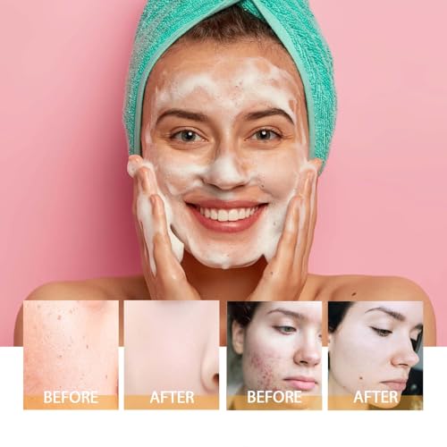 Turmeric Face Wash with Brush & Turmeric Soap Bar Care Set, 1pcs Facial Cleanser & 3pcs Soap Bar, Deep Cleansing for All Skin Types