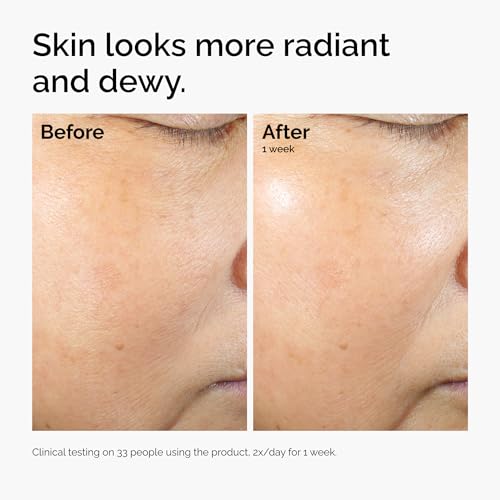 The Ordinary Rice Lipids + Ectoin Microemulsion Moisturizer 4 Fl Oz - Hydrating Barrier Repair for Dry Sensitive Skin