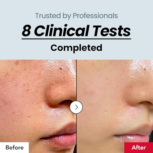 Rice Exfoliating Serum for Smooth Skin & Pore Minimization - Lightweight Korean Skincare