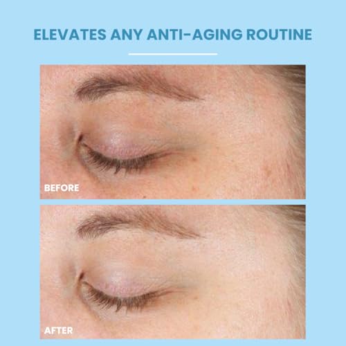 Retinol?Boost Rejuvenate Serum? - 1?% Cold?Processed Vitamin?A Night Treatment with Polyphenols, Aloe & Green Tea ? Anti?Aging, Acne?Control & Firming Face Serum, 1?fl?oz
