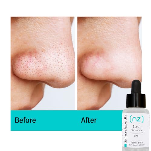 Pure Niacinamide & Zinc Face Serum, Anti Blemish Solution & Pore Minimizer, Acne Control & Oil Balancing, Clears Acne Marks & Blemishes
