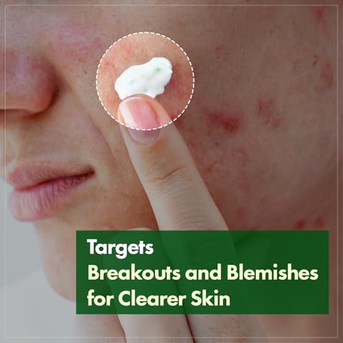 TOSOWOONG Madagascar Centella 70% Soothing & Hydrating Cream for Sensitive Skin